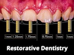 Restorative Dentistry