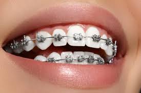 Best orthodontic in barishal Bangladesh