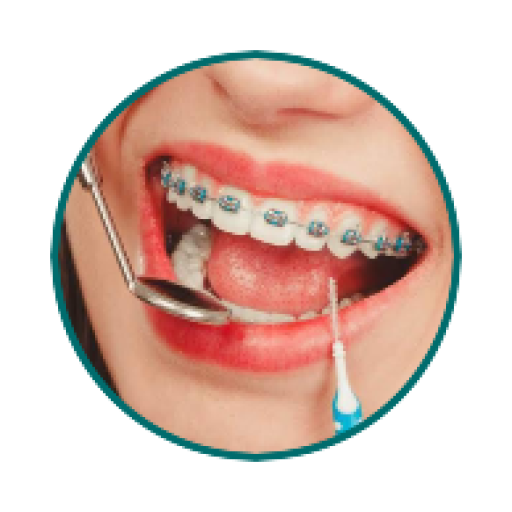 Orthodontist treatment